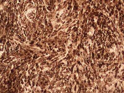 Immunohistochemistry-Paraffin: IL-17F Antibody (4H1629.1) - BSA Free [NBP2-27327]