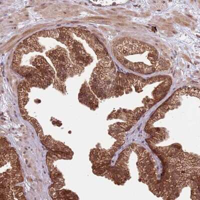 Immunohistochemistry-Paraffin: IL-17RD/SEF Antibody [NBP2-47420]