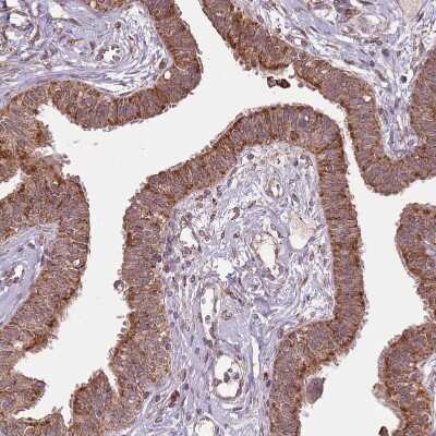 Immunohistochemistry-Paraffin: IL-17RD/SEF Antibody [NBP2-47420]