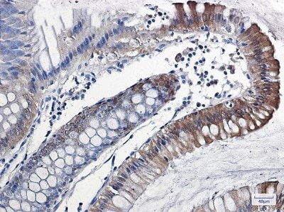 Immunohistochemistry-Paraffin: IL-18/IL-1F4 Antibody (S02-8B2) [NBP3-20042]
