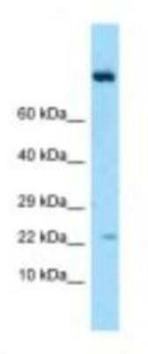 Western Blot: IL-19 Antibody [NBP1-98448]