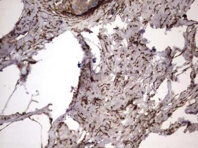 Immunohistochemistry: IL-1ra/IL-1F3/IL1RN Antibody (OTI2B1) [NBP2-45408]