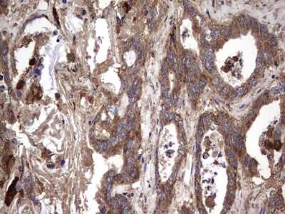 Immunohistochemistry: IL-1ra/IL-1F3/IL1RN Antibody (OTI2B1) [NBP2-45408]