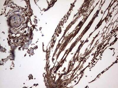 Immunohistochemistry: IL-1ra/IL-1F3/IL1RN Antibody (OTI2B1) [NBP2-45408]