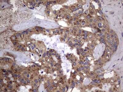 Immunohistochemistry: IL-1ra/IL-1F3/IL1RN Antibody (OTI2B1) [NBP2-45408]
