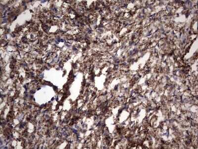 Immunohistochemistry: IL-1ra/IL-1F3/IL1RN Antibody (OTI2B1) [NBP2-45408]