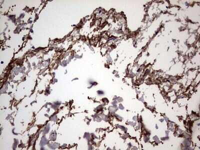 Immunohistochemistry: IL-1ra/IL-1F3/IL1RN Antibody (OTI2B1) [NBP2-45408]