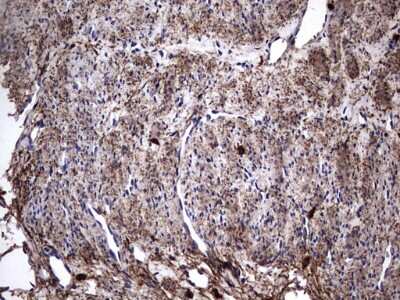 Immunohistochemistry: IL-1ra/IL-1F3/IL1RN Antibody (OTI2B1) [NBP2-45408]