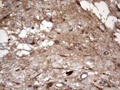 Immunohistochemistry: IL-1ra/IL-1F3/IL1RN Antibody (OTI2B1) [NBP2-45408]