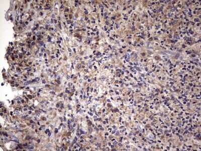 Immunohistochemistry: IL-1ra/IL-1F3/IL1RN Antibody (OTI2B1) [NBP2-45408]
