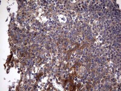 Immunohistochemistry: IL-1ra/IL-1F3/IL1RN Antibody (OTI2B1) [NBP2-45408]