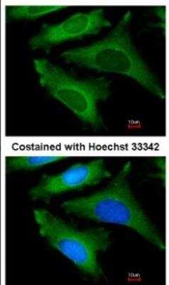 Immunocytochemistry/ Immunofluorescence: IL-1ra/IL-1F3/IL1RN Antibody [NBP1-32568]