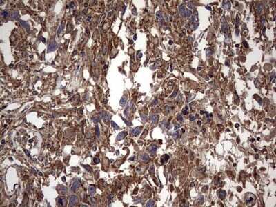 Immunohistochemistry: IL-1ra/IL-1F3/IL1RN Antibody (OTI2B1) - Azide and BSA Free [NBP2-71022]