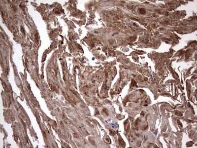 Immunohistochemistry: IL-1ra/IL-1F3/IL1RN Antibody (OTI2B1) - Azide and BSA Free [NBP2-71022]
