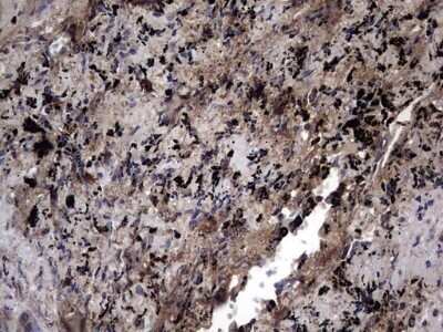 Immunohistochemistry: IL-1ra/IL-1F3/IL1RN Antibody (OTI2B1) - Azide and BSA Free [NBP2-71022]