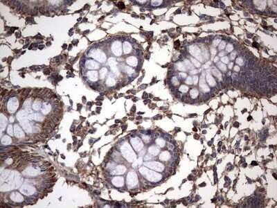 Immunohistochemistry: IL-1ra/IL-1F3/IL1RN Antibody (OTI2B1) - Azide and BSA Free [NBP2-71022]