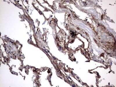 Immunohistochemistry: IL-1ra/IL-1F3/IL1RN Antibody (OTI2B1) - Azide and BSA Free [NBP2-71022]