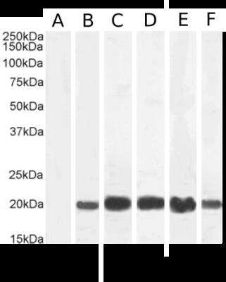 Western Blot: IL-2 Antibody (LNKB-2)ChimericAzide and BSA Free [NBP2-81047]