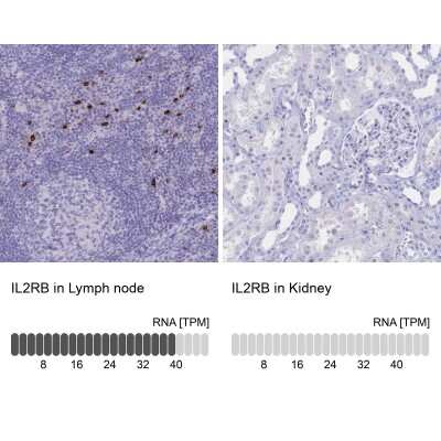 Immunohistochemistry-Paraffin: IL-2 R beta Antibody [NBP2-34148]