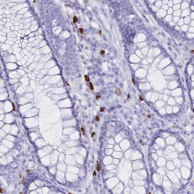 Immunohistochemistry-Paraffin: IL-2 R beta Antibody [NBP2-34148]