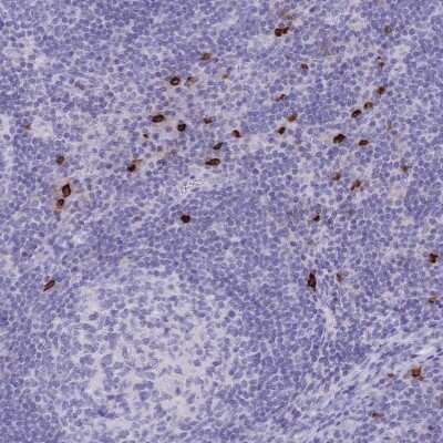 Immunohistochemistry-Paraffin: IL-2 R beta Antibody [NBP2-34148]