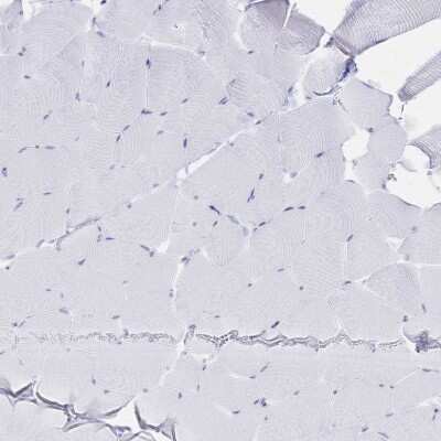 Immunohistochemistry-Paraffin: IL-2 R beta Antibody [NBP2-34148]