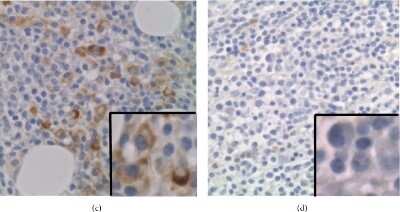 Immunohistochemistry: IL-21R Antibody [NBP1-87502]
