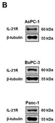 Western Blot: IL-21R AntibodyBSA Free [NBP1-76739]