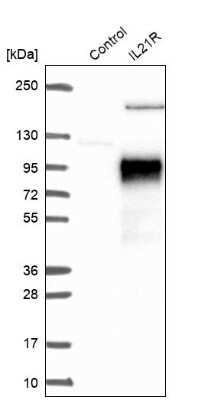 Western Blot: IL-21R Antibody [NBP1-87502]