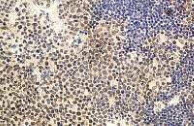 Immunohistochemistry-Paraffin: IL-22 Antibody - BSA Free [NB100-738]