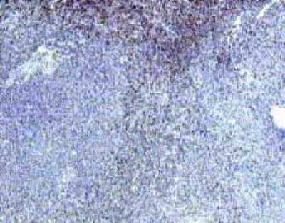 Immunohistochemistry: IL-22R alpha 1 Antibody [NB100-740]