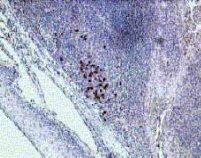 Immunohistochemistry: IL-22R alpha 1 Antibody [NB100-740]