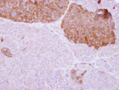 Immunohistochemistry-Paraffin: IL-22BP/IL22 RA2 Antibody [NBP1-32246]