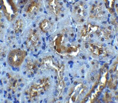 Immunohistochemistry: IL-22R alpha 1 Antibody - BSA Free [NBP1-76724]