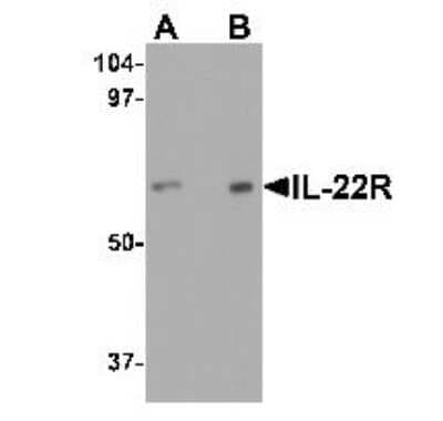 Western Blot: IL-22R alpha 1 AntibodyBSA Free [NBP1-76724]