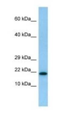 Western Blot: IL-26/AK155 Antibody [NBP1-98520]