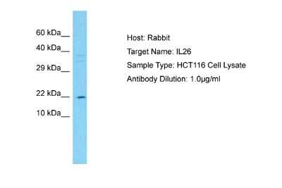 Western Blot: IL-26/AK155 Antibody [NBP1-98520]
