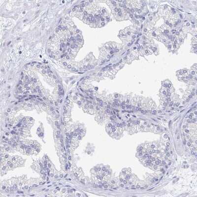Immunohistochemistry-Paraffin: EBI3 Antibody [NBP2-48852]