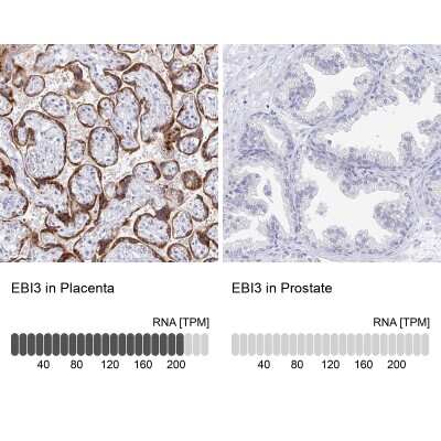 Immunohistochemistry-Paraffin: EBI3 Antibody [NBP2-48852]