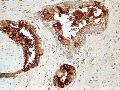 Immunohistochemistry-Paraffin: IL-27R alpha/WSX-1/TCCR Antibody (34N4G11) - BSA Free [NBP2-19015]