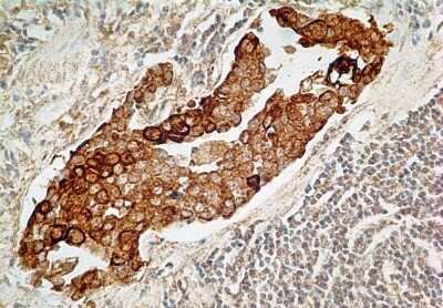 Immunohistochemistry: IL-27R alpha/WSX-1/TCCR Antibody (34N4G11) - Azide and BSA Free [NBP2-80807]