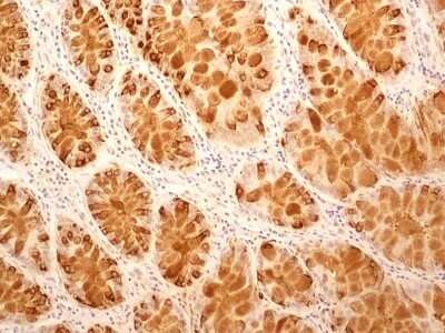 Immunohistochemistry: IL-27R alpha/WSX-1/TCCR Antibody (34N4G11) - Azide and BSA Free [NBP2-80807]
