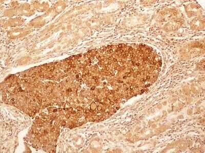 Immunohistochemistry: IL-27R alpha/WSX-1/TCCR Antibody (34N4G11) - Azide and BSA Free [NBP2-80807]