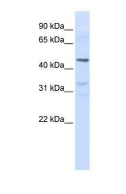Western Blot: IL-28R alpha/IFN-lambda R1 Antibody [NBP1-69635]