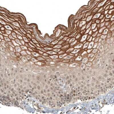 Immunohistochemistry-Paraffin: IL-28R alpha/IFN-lambda R1 Antibody [NBP1-84381]