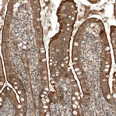 Immunohistochemistry-Paraffin: IL-28R alpha/IFN-lambda R1 Antibody [NBP1-84381]
