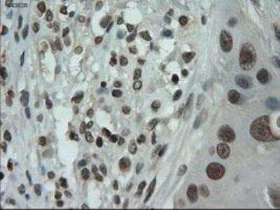 Immunohistochemistry-Paraffin: IL-3 Antibody (OTI3B11) [NBP1-47806]