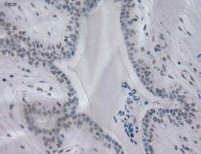Immunohistochemistry-Paraffin: IL-3 Antibody (OTI3B11) [NBP1-47806]