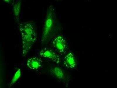 Immunocytochemistry/ Immunofluorescence: IL-3 Antibody (OTI3B11) - Azide and BSA Free [NBP2-71023]