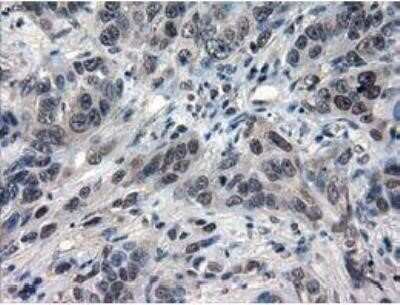 Immunohistochemistry: IL-3 Antibody (OTI3B11) - Azide and BSA Free [NBP2-71023]